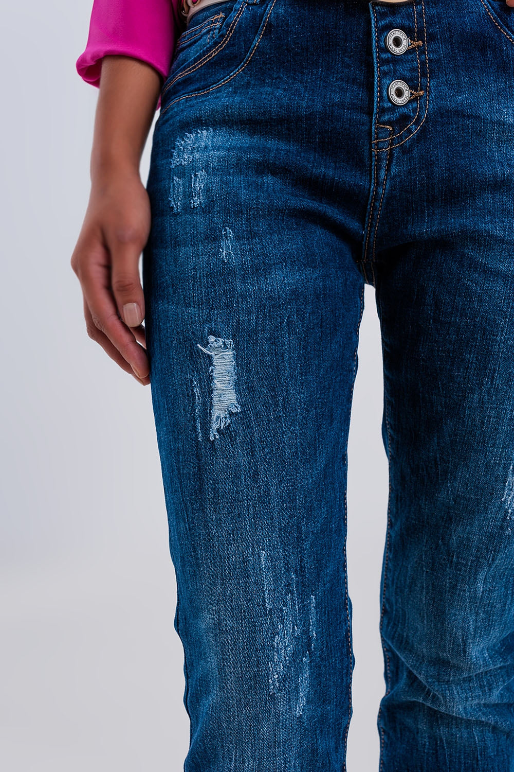Exposed button ripped boyfriend jean in dark blue Szua Store